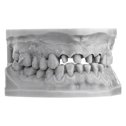 Scheu Dental - Imprimo LC Model 1kg Gris