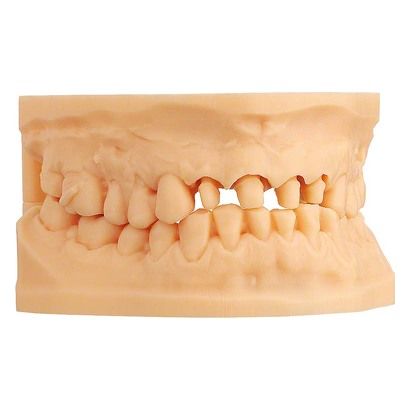 Scheu Dental - Imprimo LC Model 1kg Beige